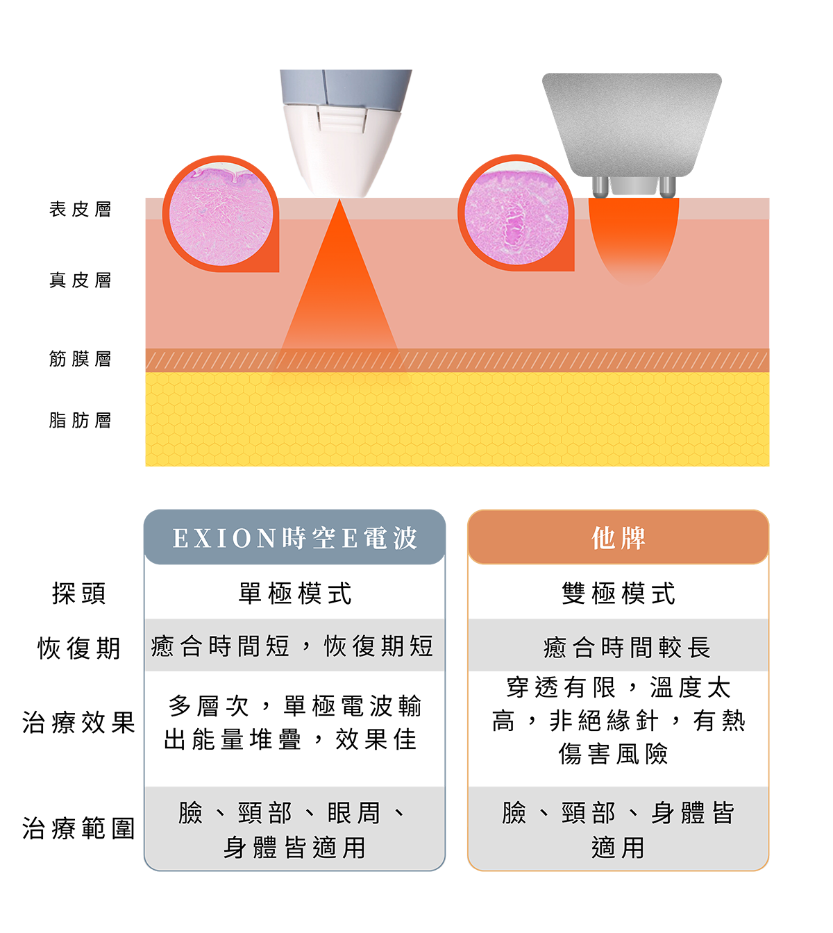 EXION 時空E電波與他牌比較|三豐診所
