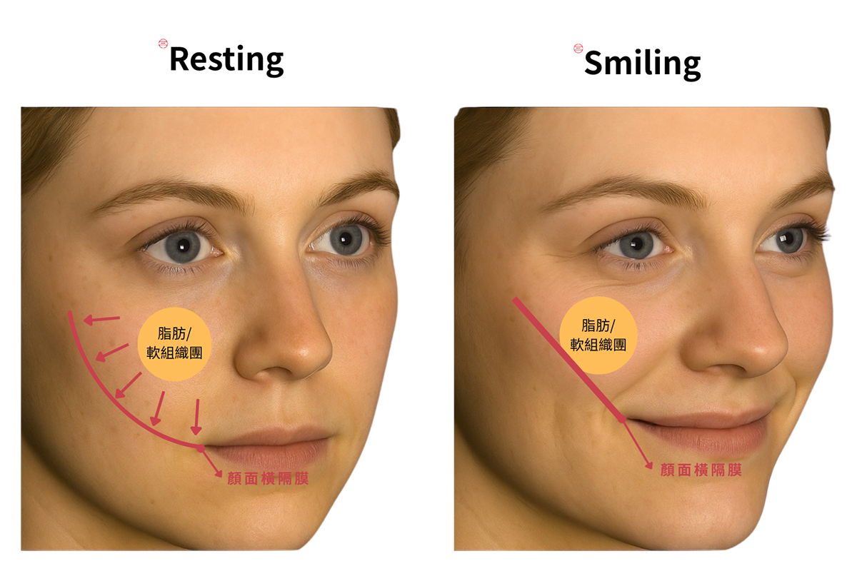 臉部饅化改善方向