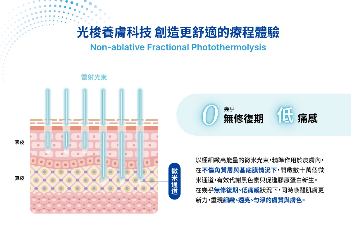 Profhilo逆時針