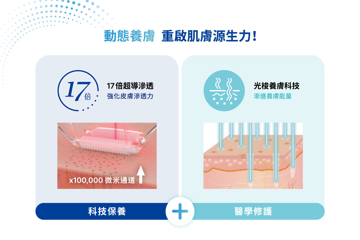什麼是Profhilo逆時針