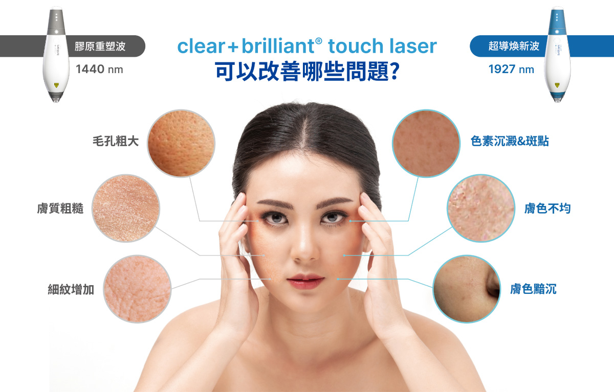 Profhilo逆時針的核心技術
